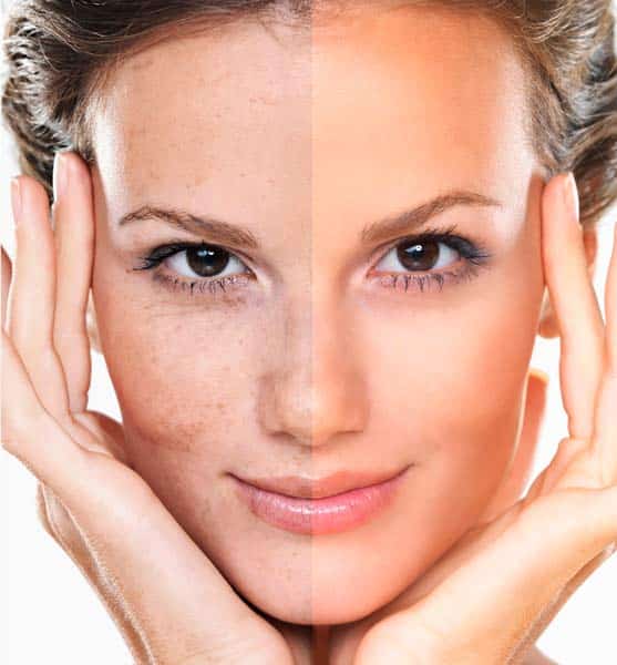 antes e depois morena