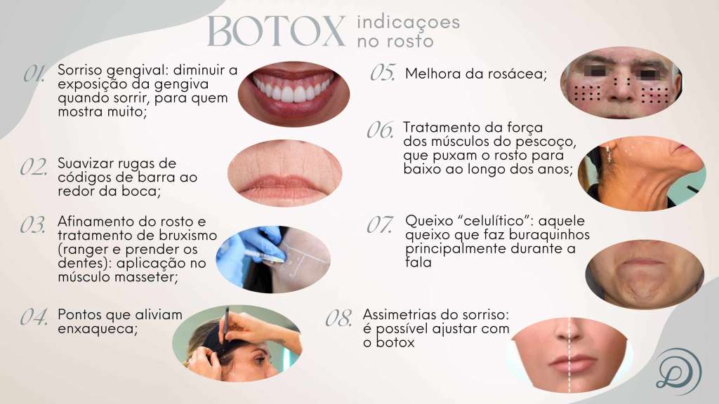 indicações de botox no rosto