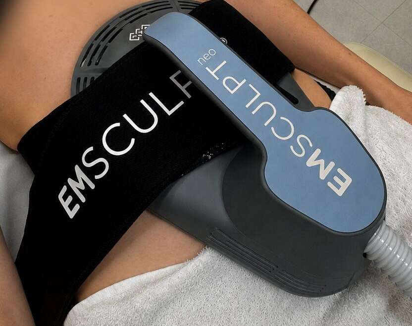 Emsculpt Neo: resultados reais, quantas sessões são necessárias e quanto tempo o efeito dura?